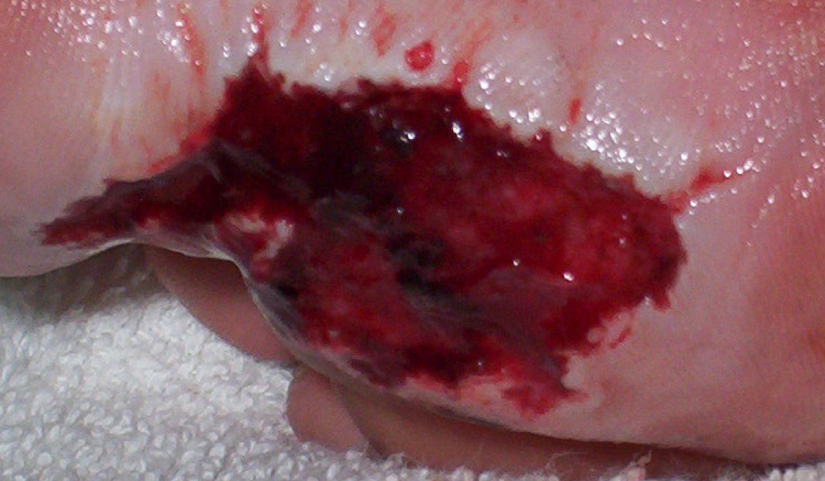 Case Study Foot Image 2