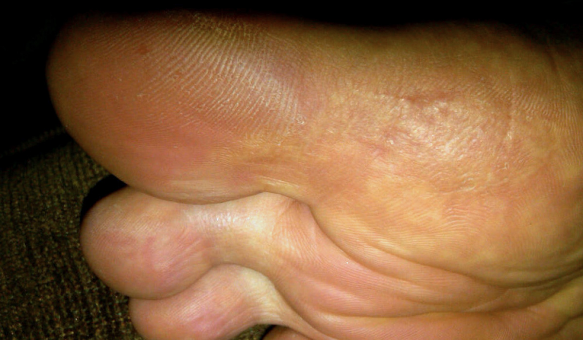 Case Study Foot Image 3