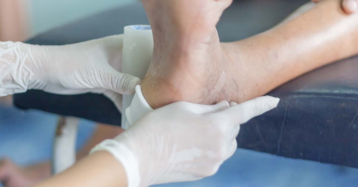 applying bandage to foot