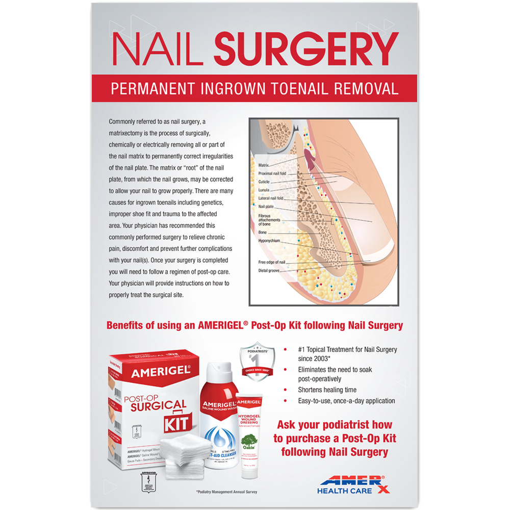 AMERIGEL Nail Surgery Poster