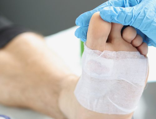 When Should I Switch a Patient’s Dressing?