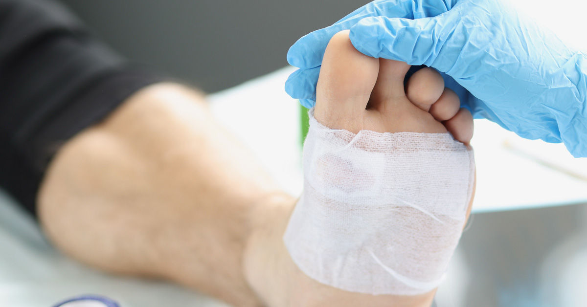Doctor looking at foot with wound covered with bandage